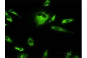 Immunofluorescence of monoclonal antibody to EEF1G on HeLa cell.