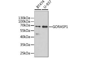 Western blot analysis of extracts of various cell lines, using GORASP1 antibody. (GORASP1 抗体  (AA 221-440))