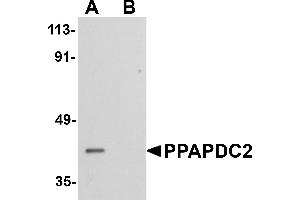 Western blot analysis of PPAPDC2 in Raji cell lysate with PPAPDC2 antibody at 1 µg/mL in (A) the absence and (B) the presence of blocking peptide. (PPAPDC2 抗体  (C-Term))