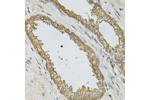 Immunohistochemistry of paraffin-embedded human prostate using PIK3CA antibody (ABIN5970095) at dilution of 1/100 (40x lens). (PIK3CA 抗体)