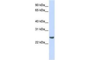 Image no. 1 for anti-NFKB Inhibitor Interacting Ras-Like 1 (NKIRAS1) (AA 36-85) antibody (ABIN6741314) (NKIRAS1 抗体  (AA 36-85))