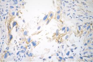 anti-Integrin beta 1 (ITGB1) antibody