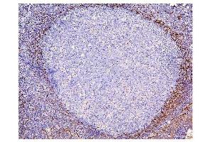 IHC analysis of ADK using anti-ADK antibody (ABIN7600222). (ADK 抗体  (AA 165-351))