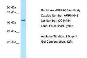 Western Blotting (WB) image for anti-Protein Kinase, AMP-Activated, gamma 3 Non-Catalytic Subunit (PRKAG3) (N-Term) antibody (ABIN971470) (PRKAG3 抗体  (N-Term))