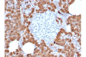 Formalin-fixed, paraffin-embedded human Pancreas stained with Carboxypeptidase A1 / CPA1 Mouse Monoclonal Antibody (CPA1/2714). (CPA1 抗体)