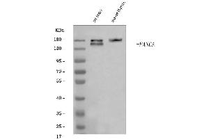 Western blot analysis of Fanca/FAA using anti-Fanca/FAA antibody (ABIN7599897).