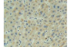 Detection of ADM in Human Liver Tissue using Polyclonal Antibody to Adrenomedullin (ADM) (Adrenomedullin 抗体  (AA 22-147))