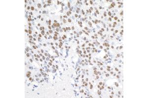 Immunohistochemistry (IHC) image for anti-Proline-, Glutamic Acid- and Leucine-Rich Protein 1 (PELP1) (AA 1000-1050) antibody (ABIN7453550)