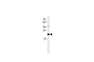 C2orf74 Antibody (C-term) (ABIN1881129 and ABIN2843610) western blot analysis in human placenta tissue lysates (35 μg/lane). (C2ORF74 抗体  (C-Term))