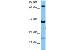 Host:  Mouse  Target Name:  TCF12  Sample Tissue:  Mouse Skeletal Muscle  Antibody Dilution:  1ug/ml (TCF12 抗体  (N-Term))