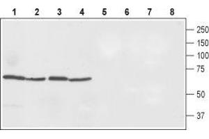 Western blot analysis of rat spleen (lanes 1 and 5), rat small intestine (lanes 2 and 6), rat liver (lanes 3 and 7) and mouse liver (lanes 4 and 8) lysates. (SLC40A1 抗体  (2nd Cytoplasmic Loop))