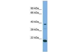 Host:  Rabbit  Target Name:  LIPT2  Sample Type:  293T Whole Cell lysates  Antibody Dilution:  1. (LIPT2 抗体  (C-Term))