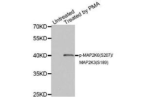 Western blot analysis of extracts of HL60 cell lines, using Phospho-MAP2K6-S207/MAP2K3-S189 antibody (ABIN5969926). (MAP2K6 抗体  (pSer207))