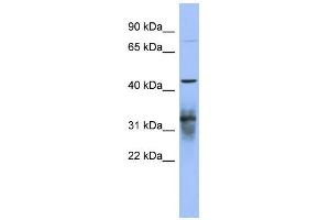 WB Suggested Anti-PABPC5 Antibody Titration:  0. (PABPC5 抗体  (N-Term))