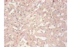 Immunohistochemical of paraffin-embedded human liver tissue using ABIN7152718 at dilution of 1:200 (FTL 抗体)