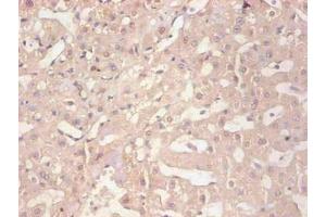 Immunohistochemical of paraffin-embedded human liver tissue using ABIN7152718 at dilution of 1:200