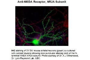Immunohistochemical staining of Anti-NMDA R2A (Rabbit) Antibody - 612-401-D89 Immunohistochemistry of Rabbit anti-NMDA R2A antibody. (NMDAR2A 抗体  (N-Term))
