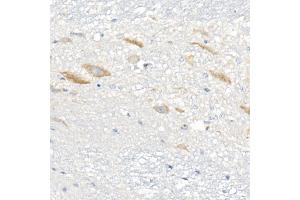Immunohistochemistry (IHC) image for anti-Acyl-CoA Synthetase Long-Chain Family Member 4 (ACSL4) antibody (ABIN7265424)