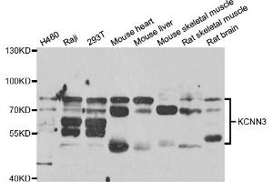 Western blot analysis of extracts of various cell lines, using KCNN3 antibody (ABIN6293039) at 1:1000 dilution. (KCNN3 抗体)