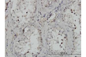 Immunoperoxidase of monoclonal antibody to CHUK on formalin-fixed paraffin-embedded human testis. (IKK alpha 抗体  (AA 646-745))