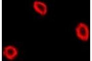 Immunofluorescent analysis of NPC2 staining in U2OS cells. (NPC2 抗体)