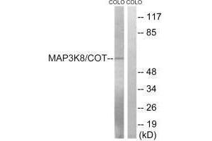 Western blot analysis of extracts from COLO cells, treated with Insulin (0. (MAP3K8 抗体  (Ser400))