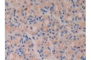 Immunohistochemistry (IHC) image for anti-Azurocidin 1 (AZU1) (AA 23-247) antibody (ABIN7433654)