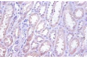 Immunohistochemistry of paraffin-embedded human kidney tissue using ABIN7173839 at dilution of 1:100 (TNFRSF1D (AA 58-208) 抗体)