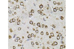 Immunohistochemistry of paraffin-embedded Mouse brain using CEP164 Polyclonal Antibody (CEP164 抗体)