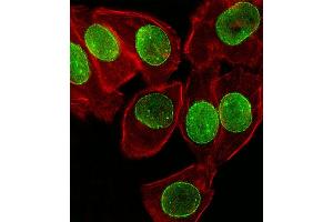 Fluorescent image of A549 cell stained with SUMO1 Antibody (N-term) (ABIN657634 and ABIN2846630). (SUMO1 抗体  (N-Term))
