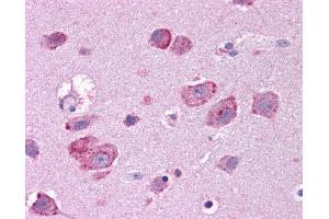 HGF antibody was used for immunohistochemistry at a concentration of 4-8 ug/ml. (HGF 抗体)