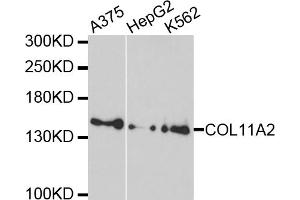 Western blot analysis of extracts of various cell lines, using COL11A2 antibody. (COL11A2 抗体)