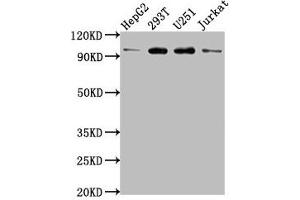 Western Blot Positive WB detected in: HepG2 whole cell lysate, 293T whole cell lysate, U251 whole cell lysate, Jurkat whole cell lysate All lanes: KPNB1 antibody at 1:2000 Secondary Goat polyclonal to rabbit IgG at 1/50000 dilution Predicted band size: 98, 82 kDa Observed band size: 98 kDa (KPNB1 抗体  (AA 9-214))