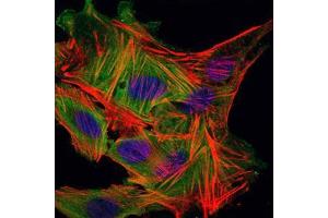 Immunofluorescence analysis of MSCS cells using MBP mouse mAb (green). (MBP 抗体)