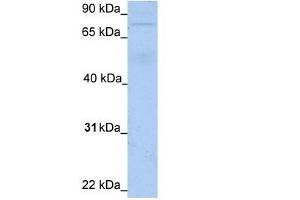 WB Suggested Anti-JPH3 Antibody Titration:  1. (Junctophilin 3 抗体  (N-Term))