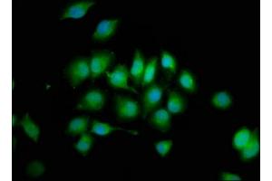 Immunofluorescence staining of A549 cells with ABIN7174107 at 1:200, counter-stained with DAPI. (PTPN3 抗体  (AA 365-505))