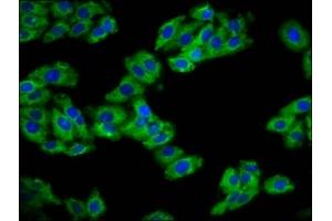Immunofluorescence staining of HepG2 cells with ABIN7154588 at 1:133, counter-stained with DAPI. (REM1 抗体  (AA 2-153))
