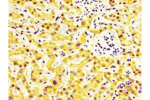 Immunohistochemistry (IHC) image for anti-Myosin Binding Protein C, Slow Type (MYBPC1) (AA 618-779) antibody (ABIN7160609)