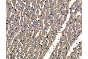ABIN7097001 and ABIN7101068 at 1/100 staining rat heart tissue by IHC-P. (SASS6 抗体)