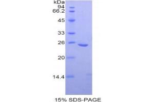 SDS-PAGE analysis of Human OSF Protein. (OSTF1 蛋白)