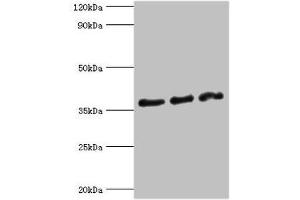 Western blot All lanes: DFFA antibody at 10 μg/mL Lane 1: Hela whole cell lysate Lane 2: 293T whole cell lysate Lane 3: PC-3 whole cell lysate Secondary Goat polyclonal to rabbit IgG at 1/10000 dilution Predicted band size: 37, 30 kDa Observed band size: 37 kDa (DFFA 抗体  (AA 1-331))