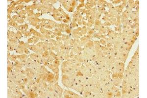 Immunohistochemistry of paraffin-embedded human heart tissue using ABIN7152437 at dilution of 1:100 (FBXO4 抗体  (AA 138-387))