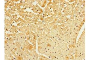 Immunohistochemistry of paraffin-embedded human heart tissue using ABIN7152437 at dilution of 1:100