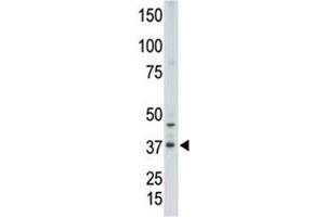 Western Blotting (WB) image for anti-Caudal Type Homeobox 2 (CDX2) (AA 1-30) antibody (ABIN3030336)