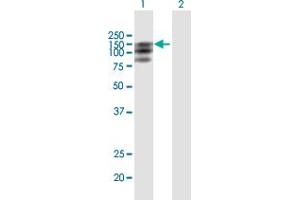Western Blot analysis of PDGFRA expression in transfected 293T cell line by PDGFRA MaxPab polyclonal antibody. (PDGFRA 抗体  (AA 1-1089))