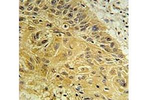 Immunohistochemistry (IHC) image for anti-Wingless-Type MMTV Integration Site Family, Member 5A (WNT5A) (AA 185-213) antibody (ABIN3029634)