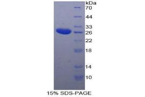 SDS-PAGE analysis of Human TPPP Protein. (Tppp 蛋白)