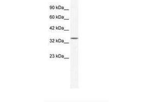 Image no. 1 for anti-Zinc Finger Protein 589 (ZNF589) (AA 185-234) antibody (ABIN203078) (ZNF589 抗体  (AA 185-234))