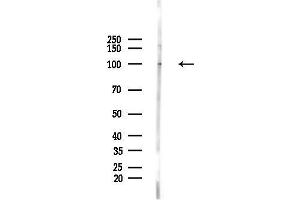 anti-Discs, Large (Drosophila) Homolog-Associated Protein 3 (DLGAP3) (N-Term) antibody