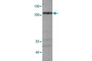 Western blot analysis of A-549 cell lysate with ADCY9 polyclonal antibody  at 1:500 dilution.